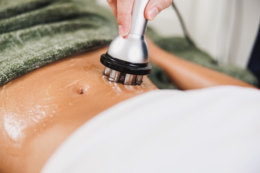 Kybella