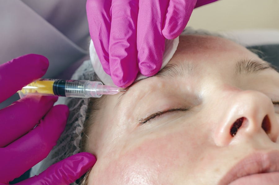 Dermal Fillers